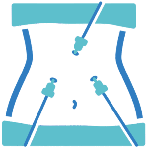Advanced Laparoscopy